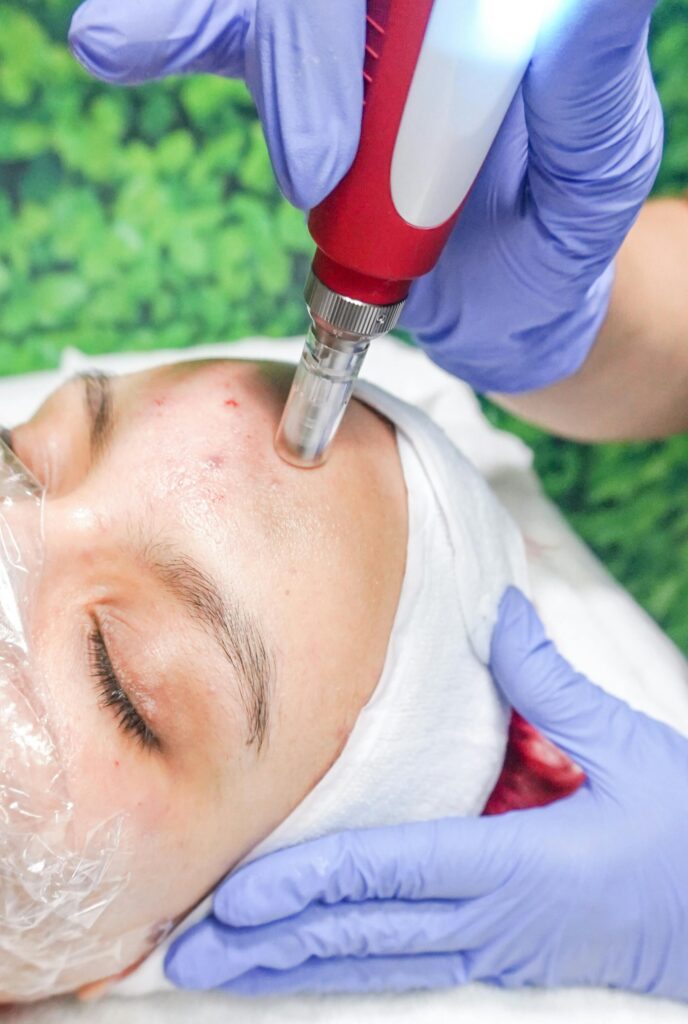 Skin Treatments